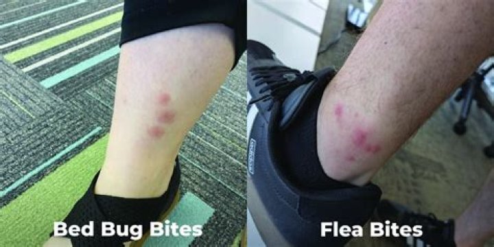 flea bite dust mite bed bug bites