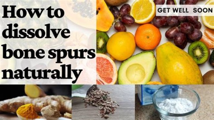 how to dissolve bone spurs naturally