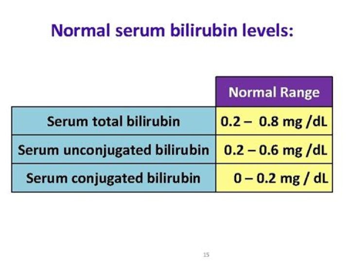 indirect bilirubin normal range