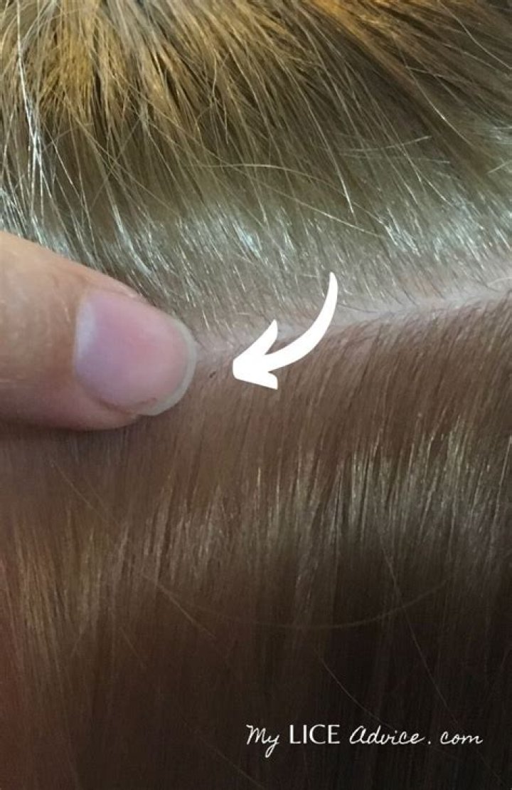 lice in blonde hair
