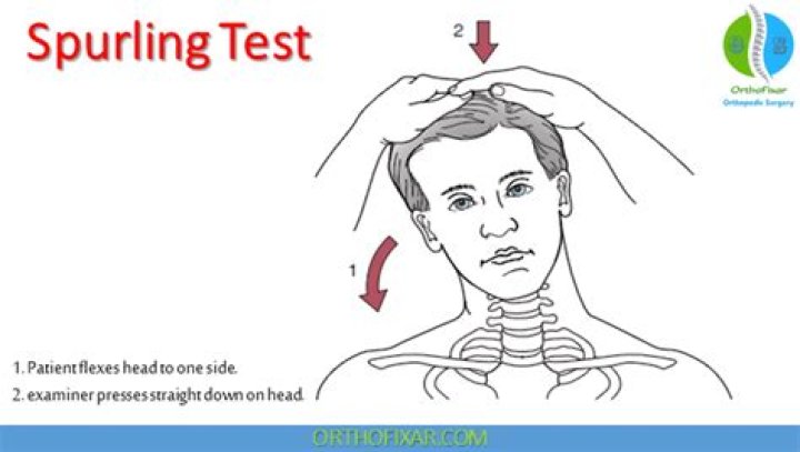 spurling test