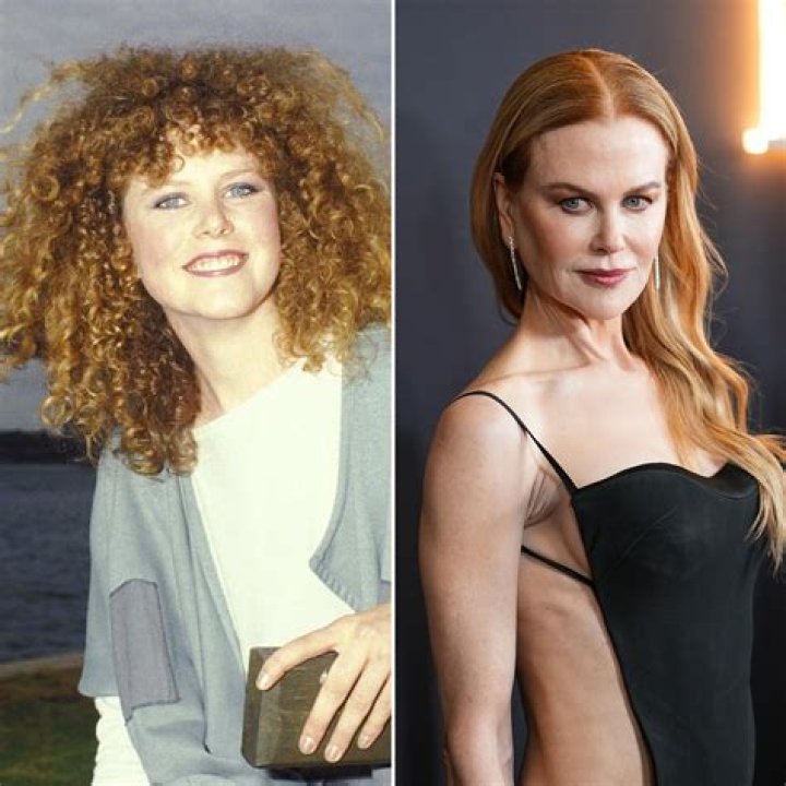 The Truth About Nicole Kidman's Lioness-Like Plastic Surgery Transformation