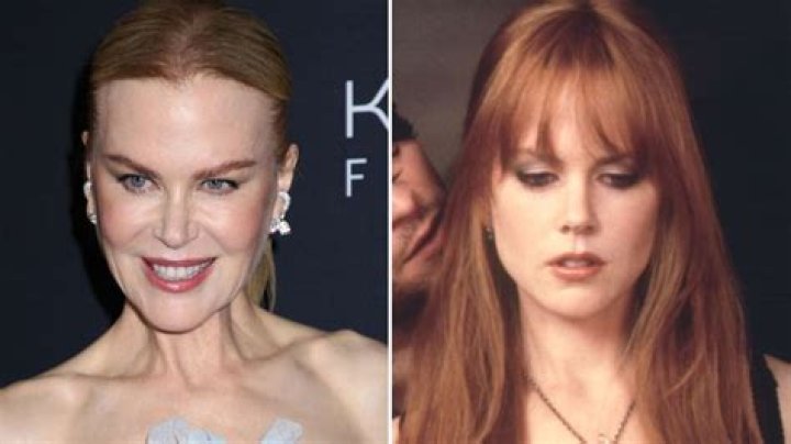 Uncover The Intriguing Story Behind Nicole Kidman's Scar